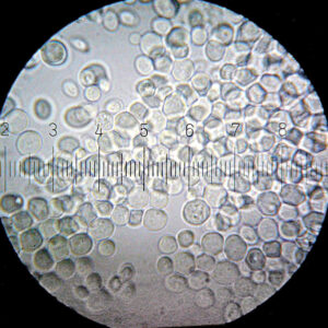 microscope image of yeast 