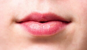 chapped lips photo